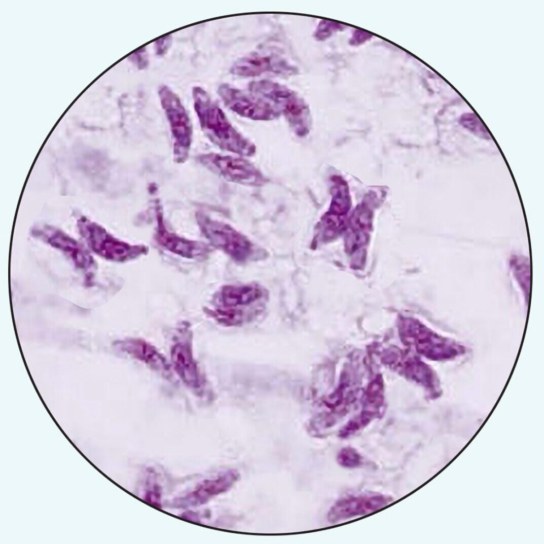Toxoplasma gondii stained smear
